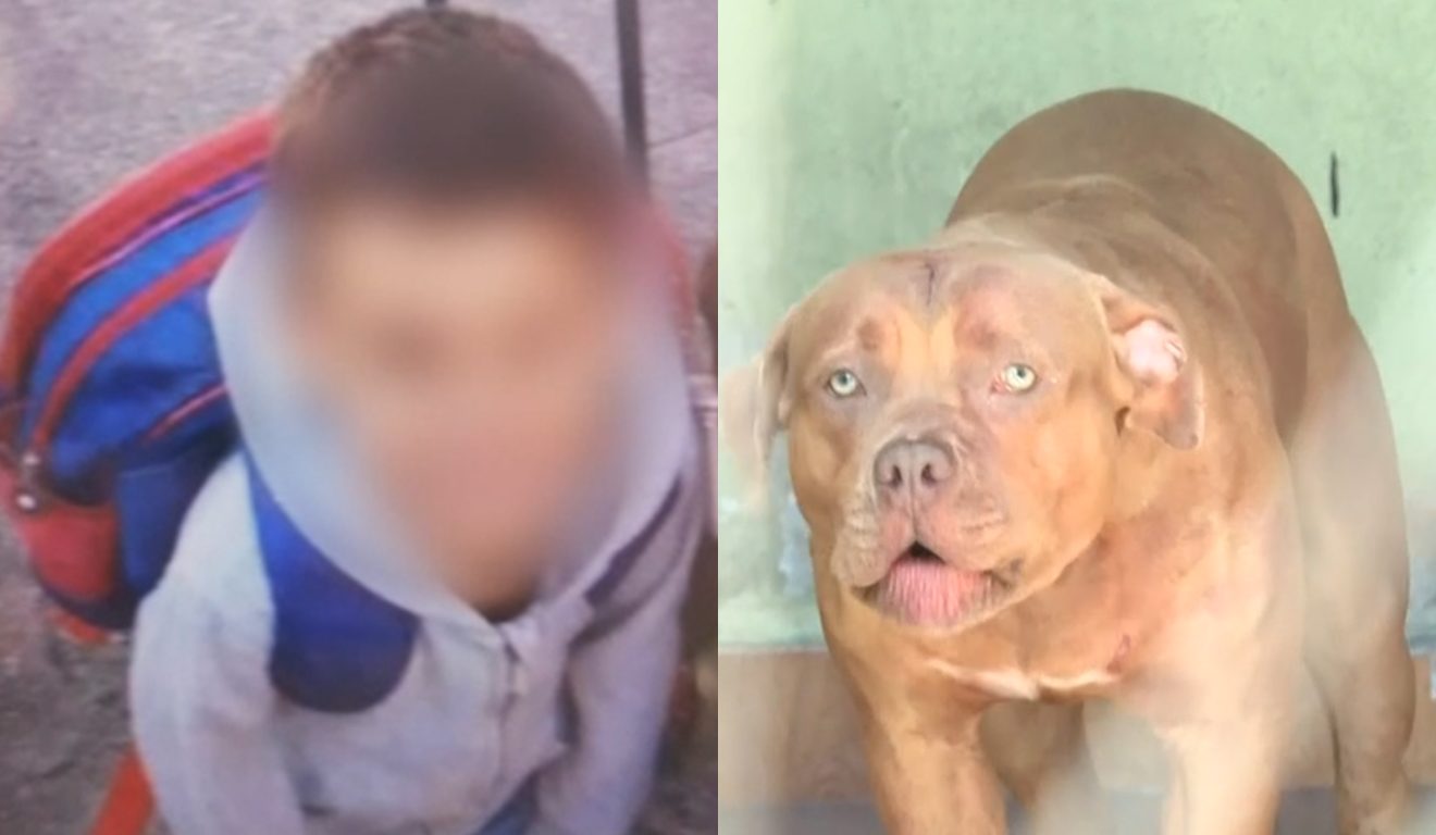 Criança de 4 anos morre após ser atacada no pescoço por pitbull
