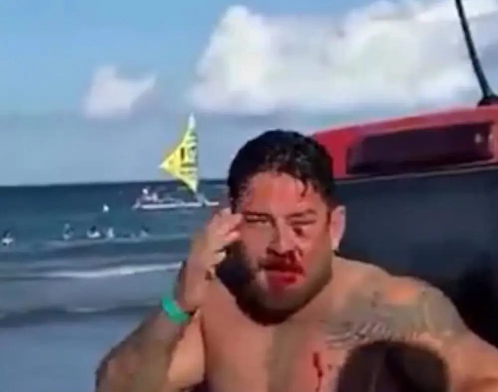 ‘Teve motivação homofóbica’, diz casal de turistas agredido em praia de Porto de Galinhas