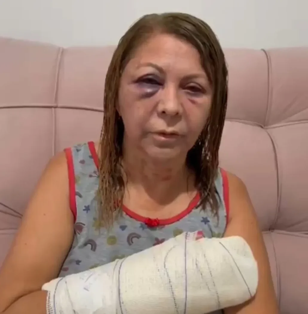 Hóspede invade banheiro, tenta estuprar e espanca recepcionista em Curitiba
